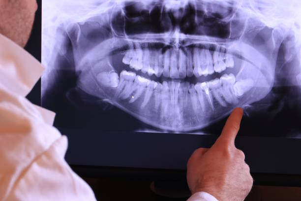 Best Emergency Wisdom Teeth Removal in Washington Park, FL