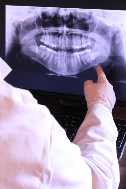 Best Emergency Root Canal Treatment in Washington Park, FL